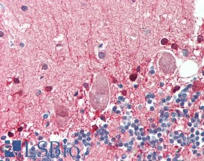 IHC-plus™ Monoclonal Mouse anti-Human PGAM1 Antibody (IHC, WB)