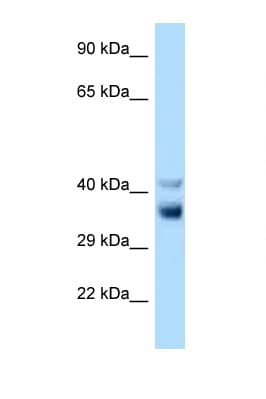 NEK7 Antibody (C-Terminus)