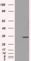 CD32A Antibody (clone OTI6H7)