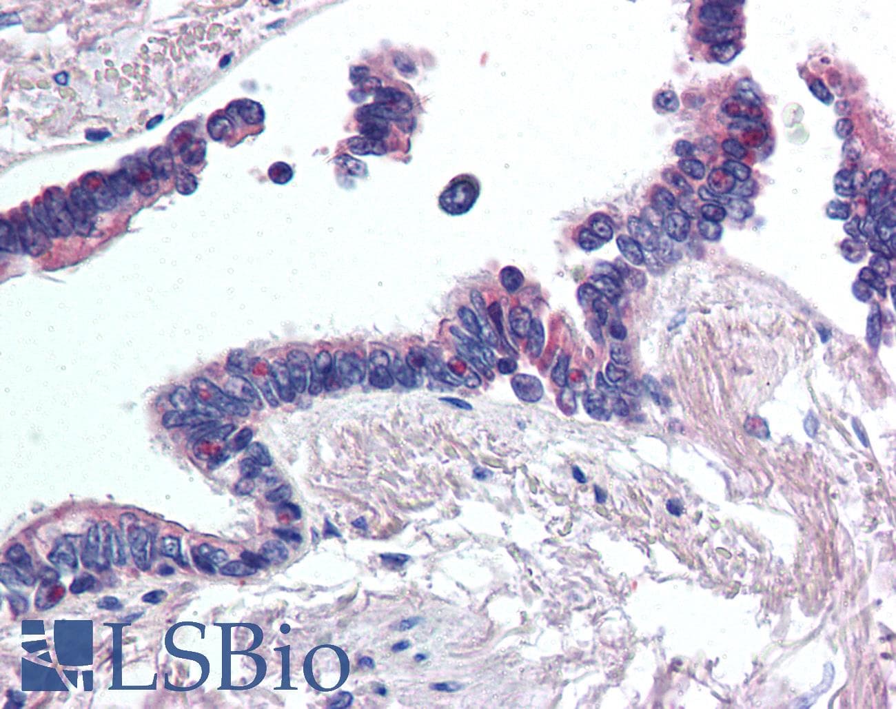 IHC-plus™ WNT2 / IRP Antibody (Internal)