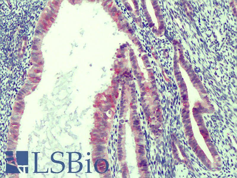 IHC-plus™ RCAN2 / RCN2 Antibody
