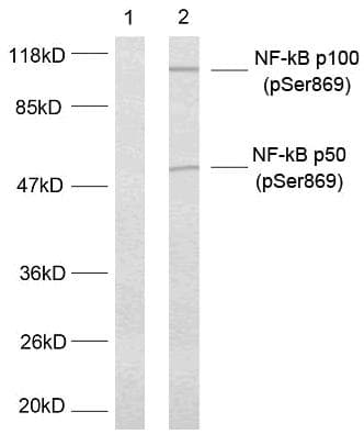 Polyclonal Rabbit anti-Human NFKB2 Antibody (phospho-Ser869, IHC, WB)