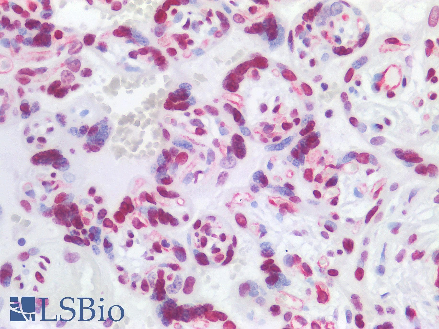 IHC-plus™ Polyclonal Rabbit anti-Human HIST1H1B Antibody (IHC, IF, WB)