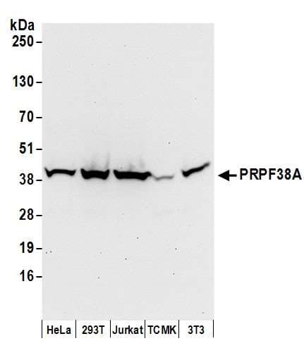 Polyclonal Rabbit anti-Human PRPF38A Antibody (aa262-312, WB)