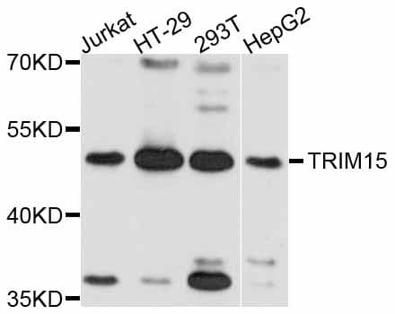 Polyclonal Rabbit anti-Human TRIM15 Antibody (IHC, WB)