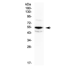 CHEK1 / CHK1 Antibody