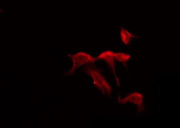 MTNR1B / MT2 Antibody
