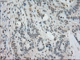 BUB1B / BubR1 Antibody (clone OTI3C7)