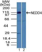 NEDD4 Antibody (aa200-250)