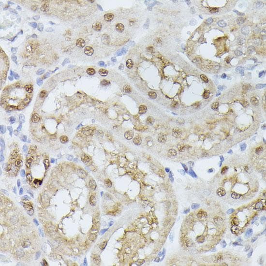 TPI1 / TPI Antibody
