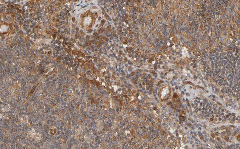 Polyclonal Rabbit anti-Human TNFSF11 / RANKL / TRANCE Antibody (IHC, IF, WB)