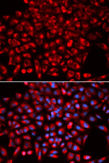 IHC-plus™ Polyclonal Rabbit anti-Human AIMP1 / EMAP II Antibody (IHC, IF, WB)