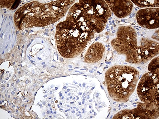 AZGP1 / ZAG Antibody (aa21-298, clone OTI2H3)