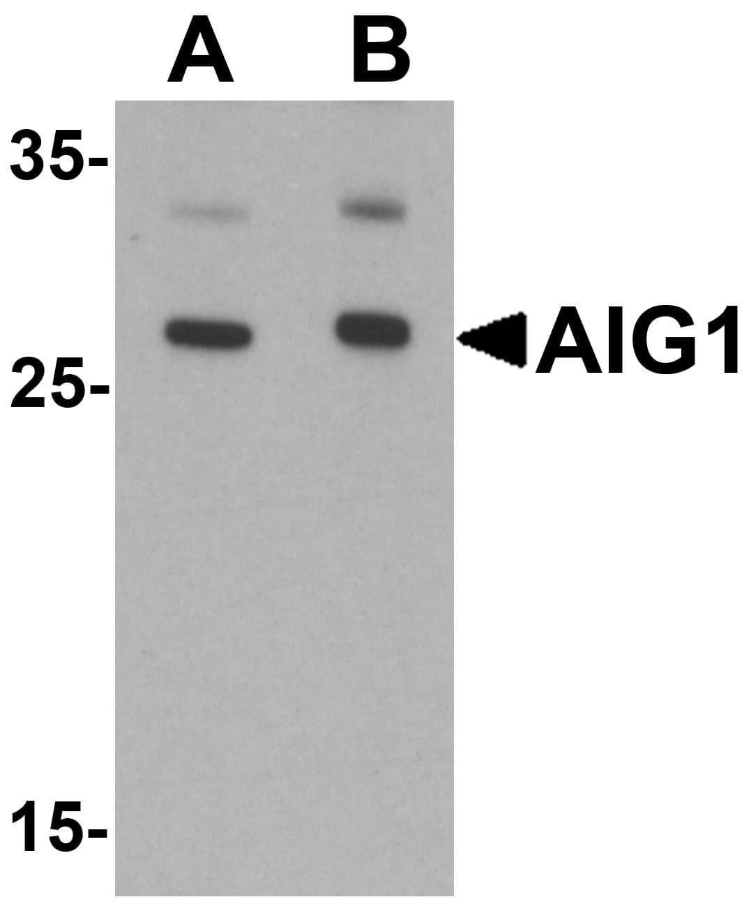 IHC-plus™ AIG1 Antibody