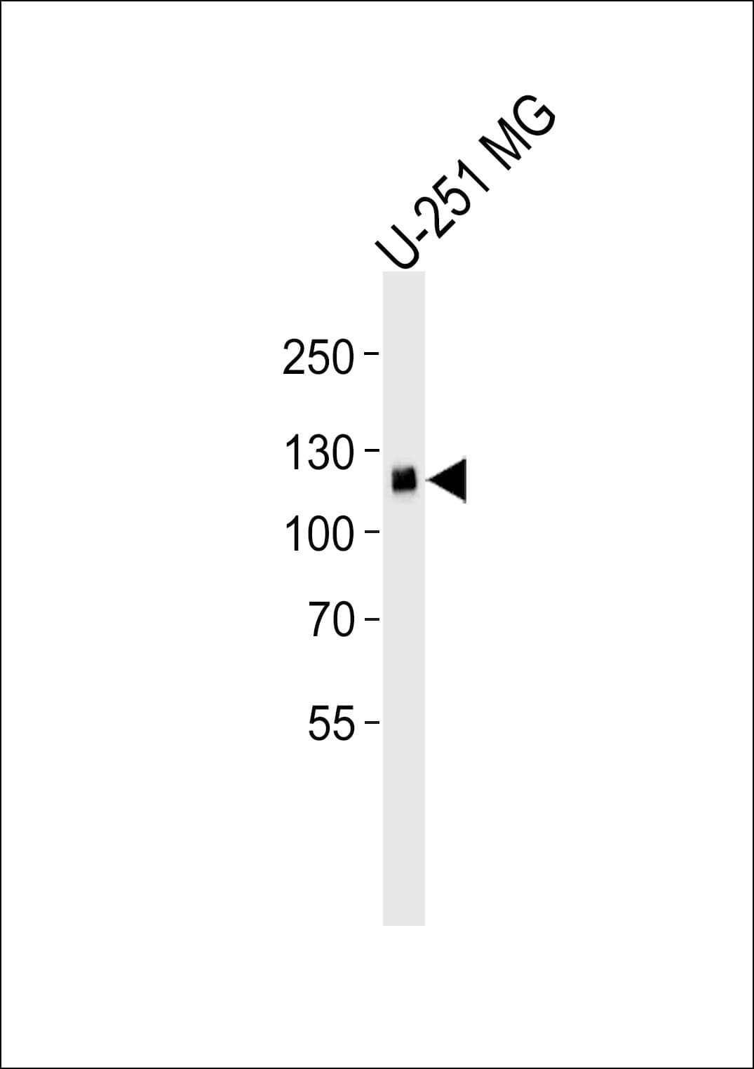 EPHA5 / EPH Receptor A5 Antibody (clone 46CT61.6.4)