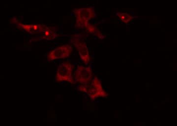 Polyclonal Rabbit anti-Human CYP4V2 Antibody (aa339-364, IHC, IF, WB)