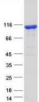 Human FAM160B1 Protein (Recombinant Myc-DDK (Flag))