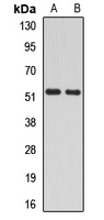 RAD23A / HHR23A Antibody