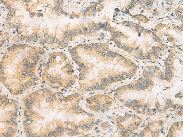Polyclonal Rabbit anti-Human RAB13 Antibody (IHC)