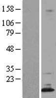 DPPA5 Protein (Over-Expression Lysate Myc-DDK (Flag))