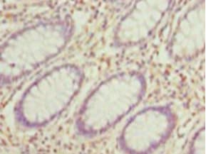 HDAC1 Antibody