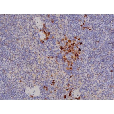 Polyclonal Rabbit anti-Human BCL2L1 / BCL-XL Antibody (phospho-Thr47, IHC, IF, WB)