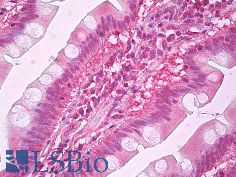 IHC-plus™ Monoclonal Mouse anti-Human GC1qR / C1QBP Antibody (aa74-282, IHC, IF, WB)