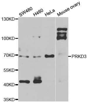 PKD3 / PRKD3 Antibody