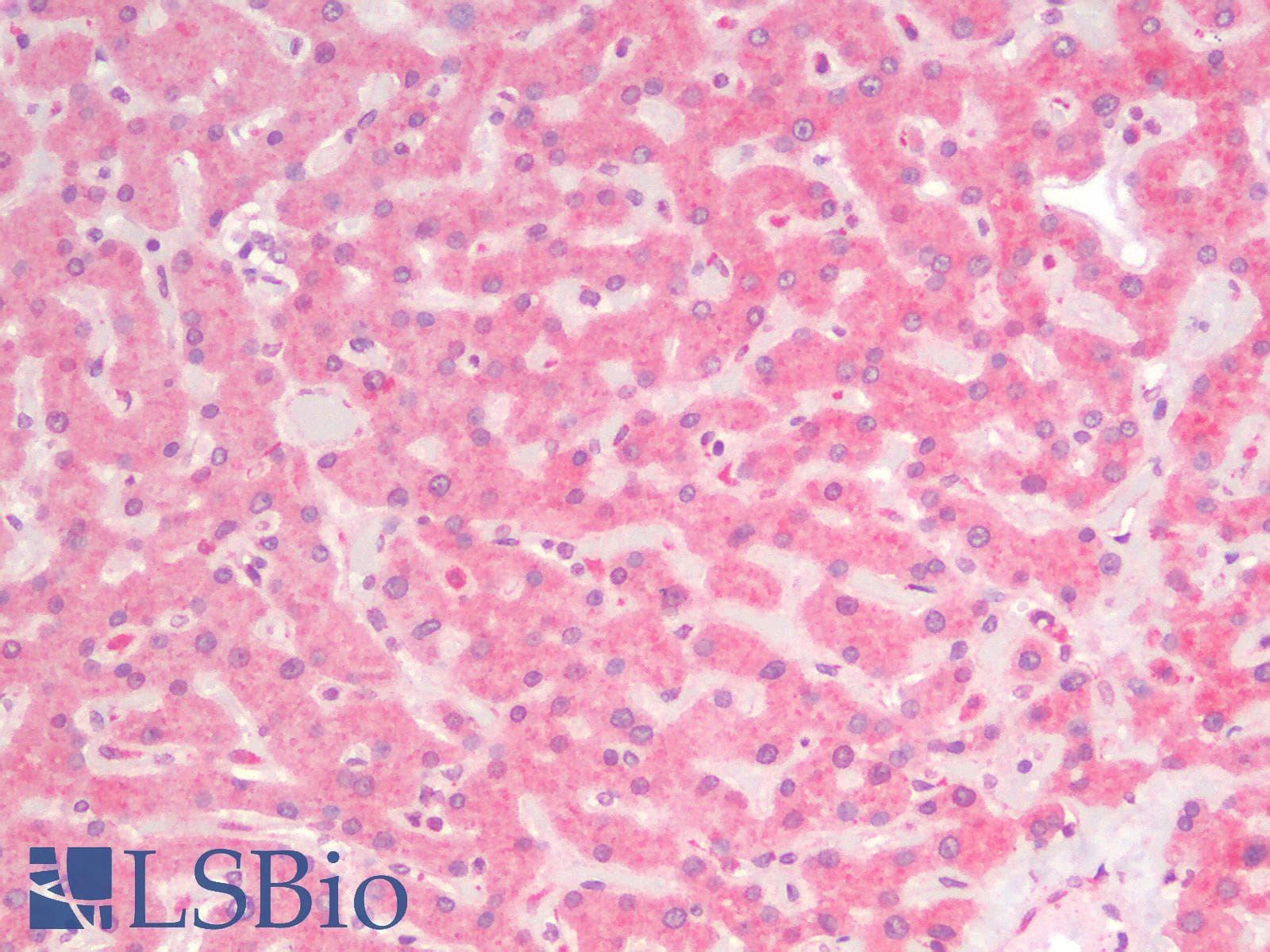 PathPlus™ Polyclonal Rabbit anti-Human CDH1 / E Cadherin Antibody (IHC)