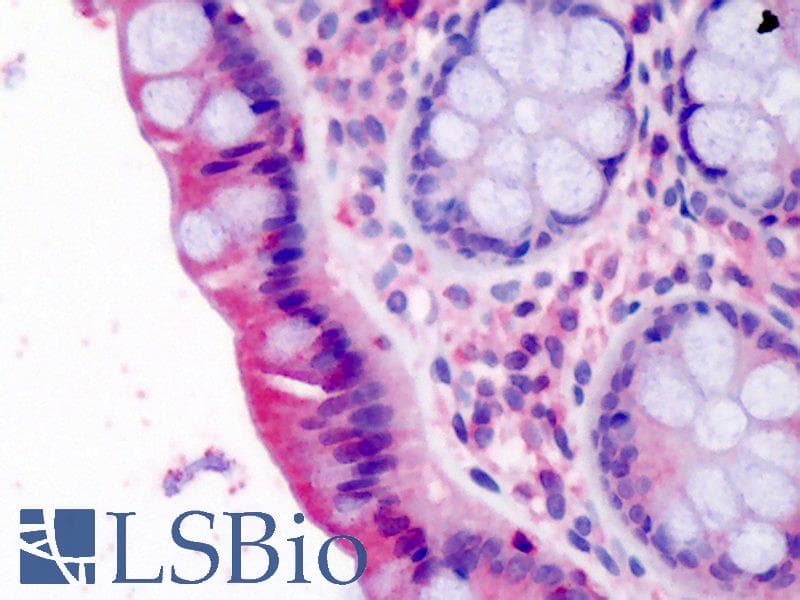 IHC-plus™ Polyclonal Goat anti-Human LASP1 Antibody (aa141-153, IHC, WB)