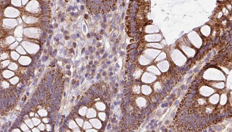 BBS2 / BBS Antibody