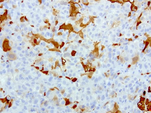 S100A9 / MRP14 Antibody (clone UMAB174, Carrier-free)
