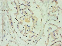 SULT2B1 / Sulfotransferase 2B1 Antibody (aa1-365)