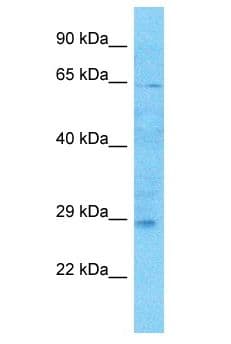 TMEM215 Antibody (aa76-125)