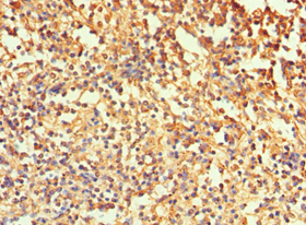 CA1 / Carbonic Anhydrase I Antibody (aa1-261)