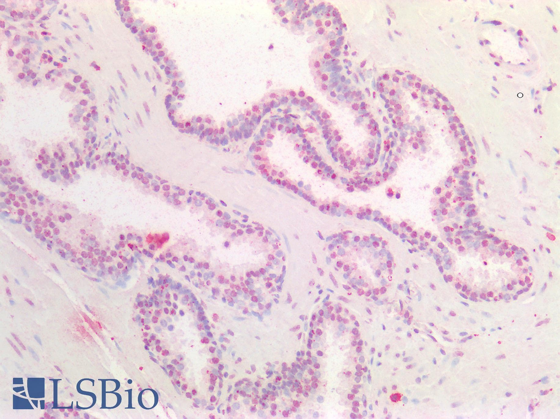 IHC-plus™ Polyclonal Goat anti-Human HOXA5 Antibody (IHC, WB)