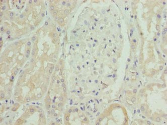 Polyclonal Rabbit anti-Human SLC46A3 Antibody (IHC, WB)