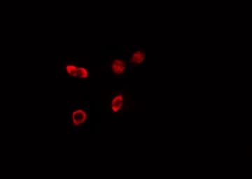 Polyclonal Rabbit anti-Human HKR1 Antibody (IF, WB)