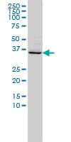 FOXR2 Antibody (clone 2C1)