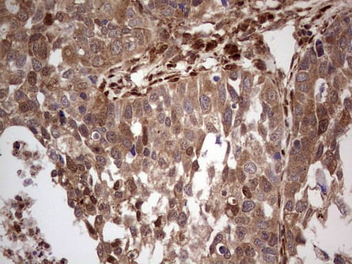 IHC-plus™ Monoclonal Mouse anti-Human LGALS9 / Galectin 9 Antibody (clone 21B5, IHC, WB)