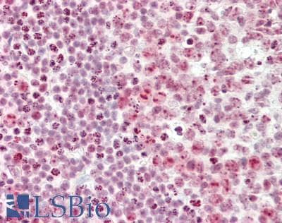 CSTF3 Antibody (aa71-120)