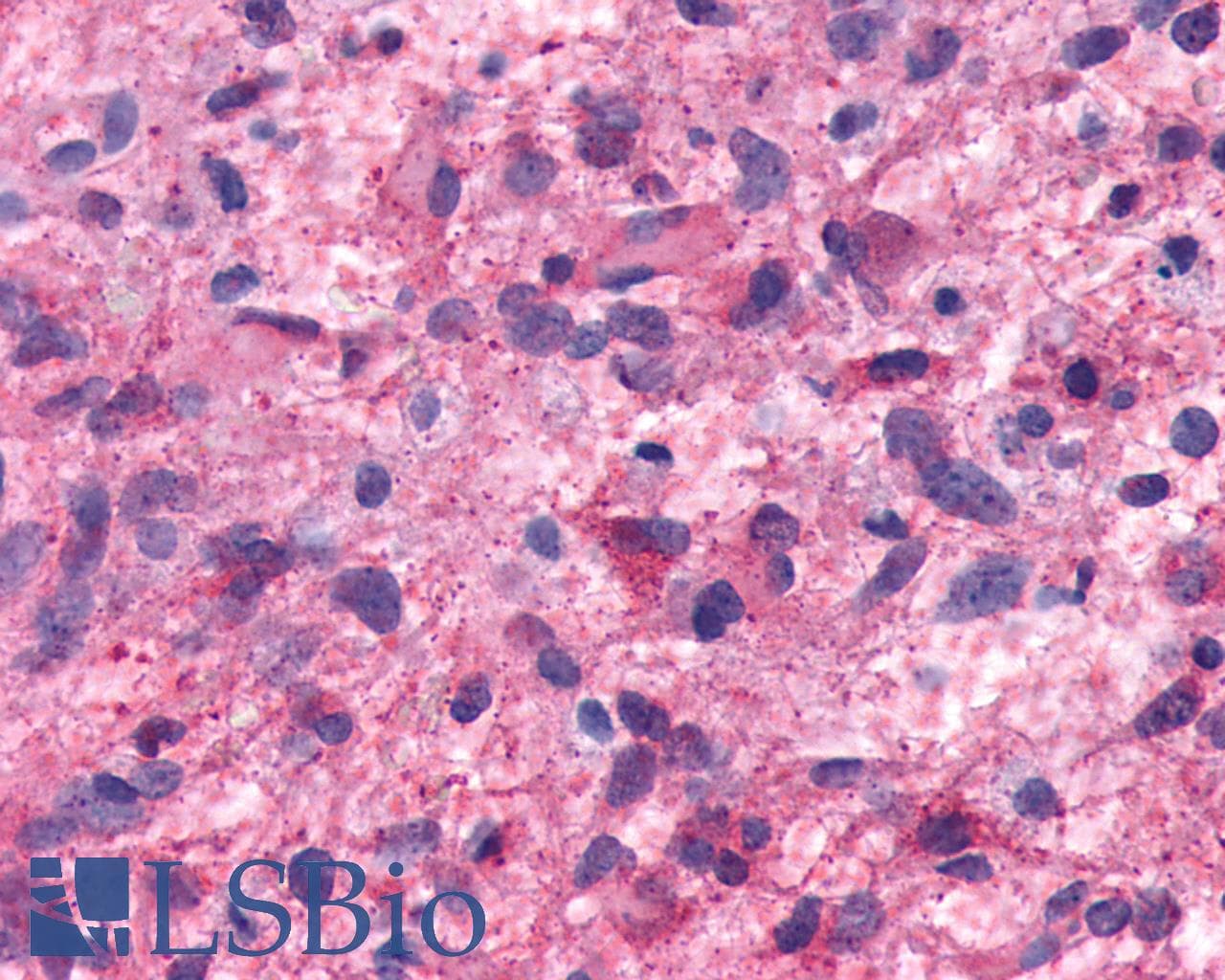 IHC-plus™ HTR7 / 5HT7 Receptor Antibody (N-Terminus)