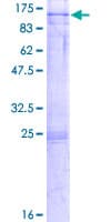 Human NOP14 / C4orf9 Protein (Recombinant GST)