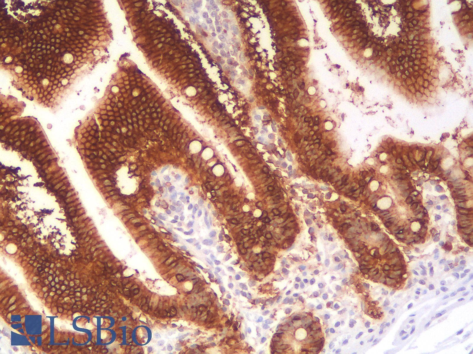 IHC-plus™ Recombinant Monoclonal Rabbit anti-Human EPCAM Antibody (clone EGP40/2041R, aa100-224, IHC, WB)