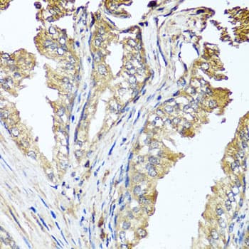 STK3 Antibody