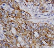 CTNNB1 / Beta Catenin Antibody (C-Terminus, Sepharose)