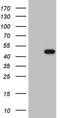 NKX2-1 / Thyroid-Specific TF Antibody (clone OTI15A10)