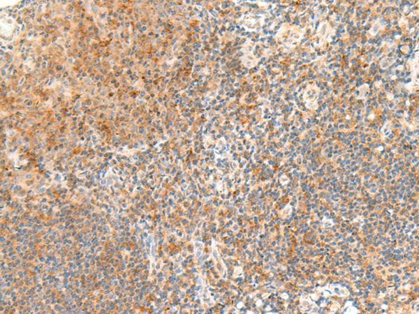 Polyclonal Rabbit anti-Human RAPGEF1 Antibody (IHC)