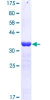 Human KDM6A / UTX Protein (Recombinant GST, N-terminus)
