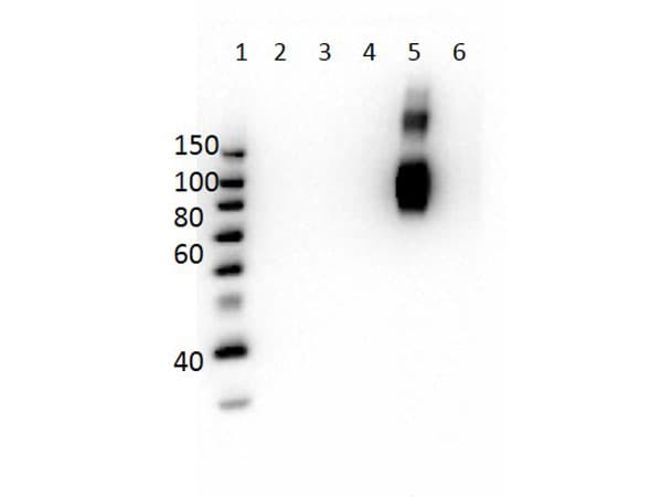Hemoglobin Gamma (HBG1 + HBG2) Antibody (N-Terminus, clone 4B3.B5.F3.B7)